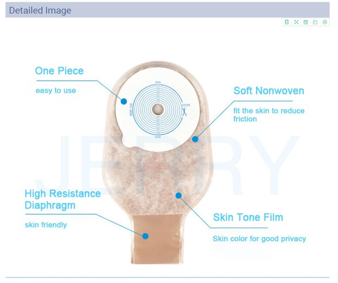 Stoma Bag Explained